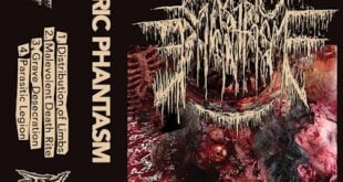 Gastric Phantasm